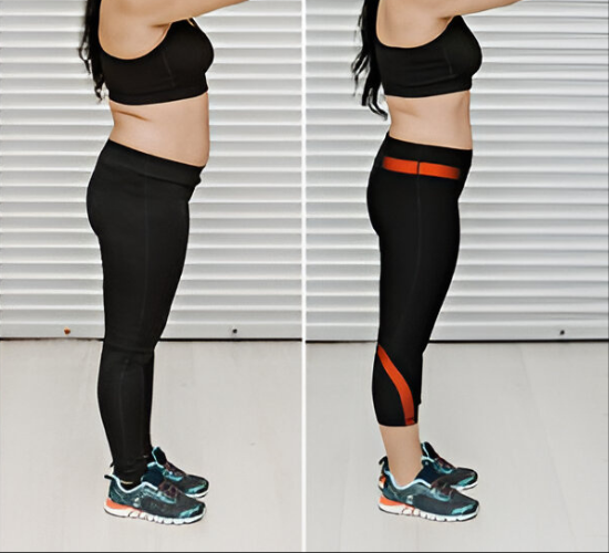 Artifect slimming belt for weight loss in UAE – best tummy slimming belt for women