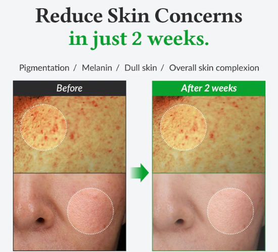 Before and after skin treatment comparison after using Dr. Althea 345 Cream & Vitamin C Serum.